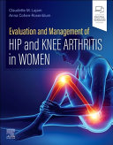 Evaluation and Management of Hip and Knee Arthritis in Women, 1st Edition