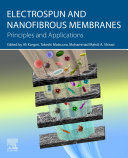  Electrospun and Nanofibrous Membranes