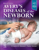  Avery's Diseases of the Newborn