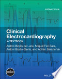 Clinical Electrocardiography: A Textbook