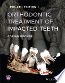 Orthodontic Treatment of Impacted Teeth