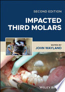  Impacted Third Molars