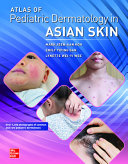 Atlas of Pediatric Dermatology in Asian Skin 1st Edition