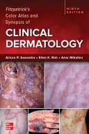Fitzpatrick's Color Atlas and Synopsis of Clinical Dermatology,