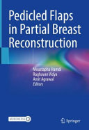 Pedicled Flaps in Partial Breast Reconstruction 