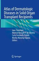 Atlas of Dermatologic Diseases in Solid Organ Transplant Recipients