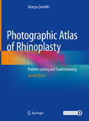  Photographic Atlas of Rhinoplasty: Problem-solving and Troubleshooting