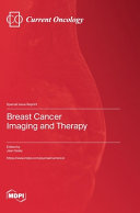  Breast Cancer Imaging and Therapy