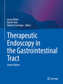  Therapeutic Endoscopy in the Gastrointestinal Tract