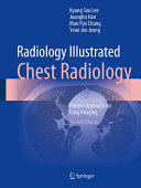 Radiology Illustrated - Chest Radiology - Pattern Approach for Lung Imaging, 2e (Feb 10, 2024)_(9819966329)_(Springer)
